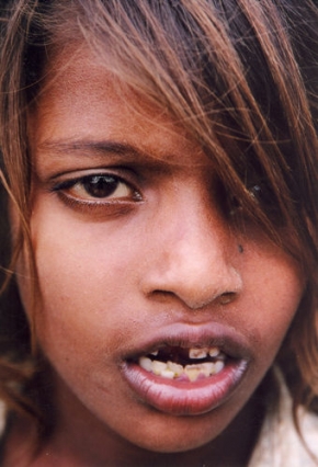 Portrét opravdového člověka - Fotograf roku - Jednoočko, Džanakpur, Nepál